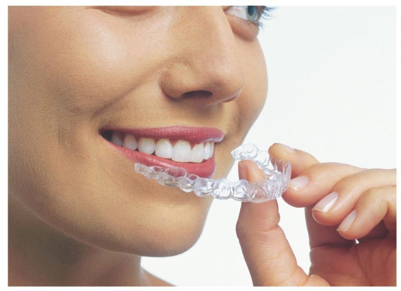 invisalign